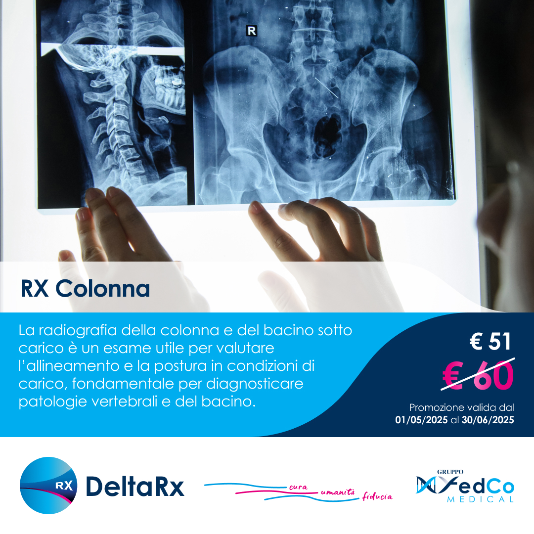 Radiografia della colonna e del bacino sotto carico – Promo a € 51,00!